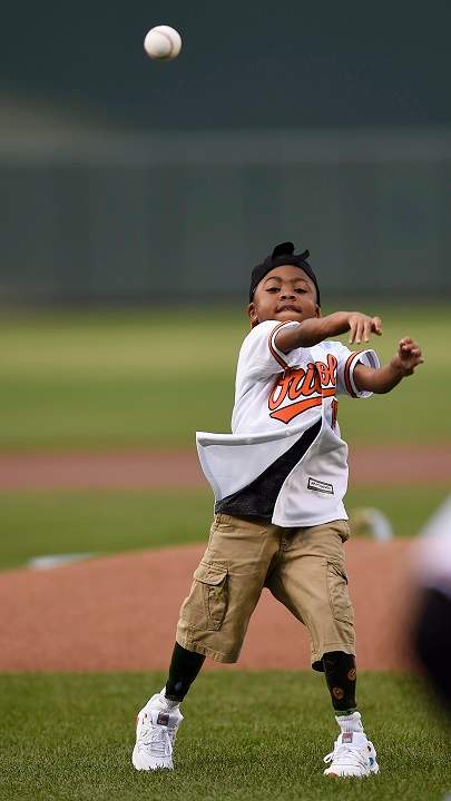 Boy with double-hand transplant throws first pitch at MLB game - image
