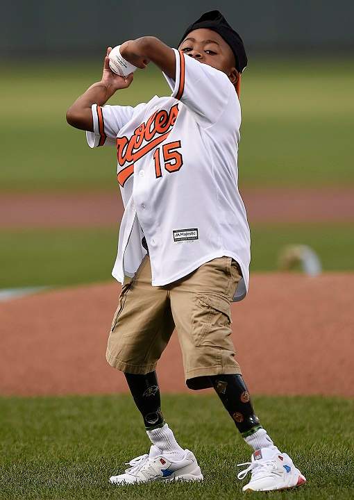 Nine-year-old Zion Harvey, the world’s first child to receive a bilateral hand transplant, throws out the first pitch before the Baltimore Orioles and Texas Rangers baseball in Baltimore, Tuesday, Aug. 2, 2016.