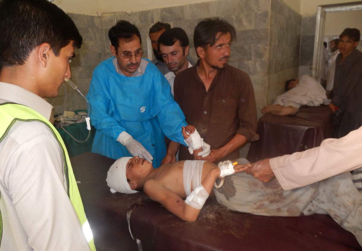 A Pakistani child who was injured in a suicide bombing is treated at a local hospital in Khar, Pakistan, Friday, Sept. 16, 2016. 