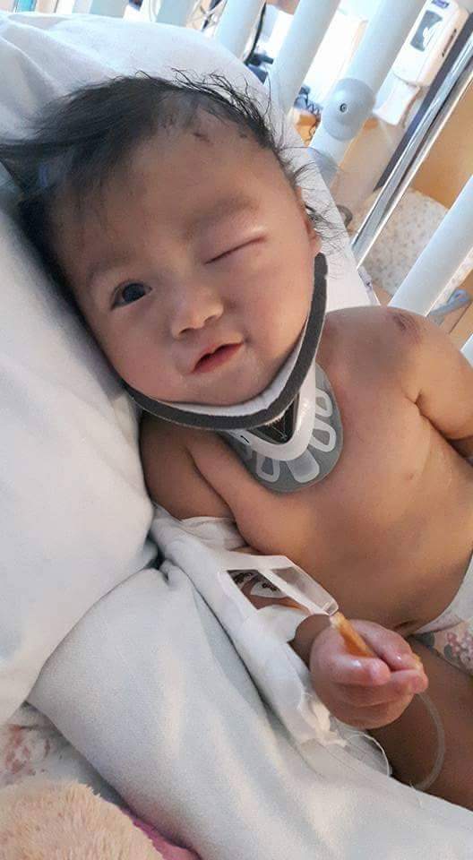 Emma-Marie’s parents say she is recovering well and will undergo an MRI on Tuesday.