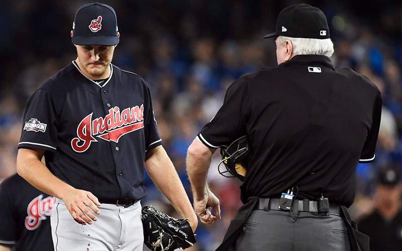 Cleveland Indians starting pitcher Trevor Bauer looks at his bleeding finger against the Toronto Blue Jays during first inning, game three American League Championship Series baseball action in Toronto on Monday, October 17, 2016. 
