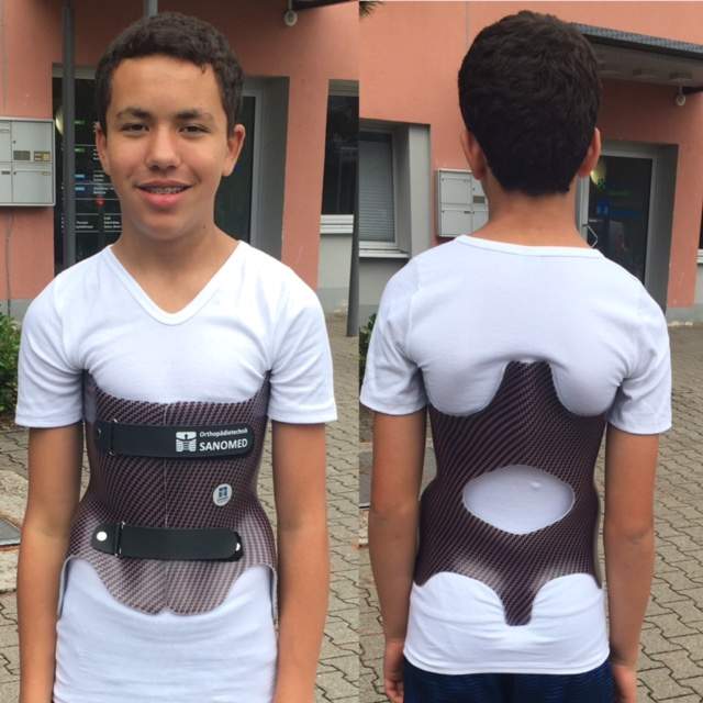 Saskatoon family travels overseas for modern back brace option for son - image