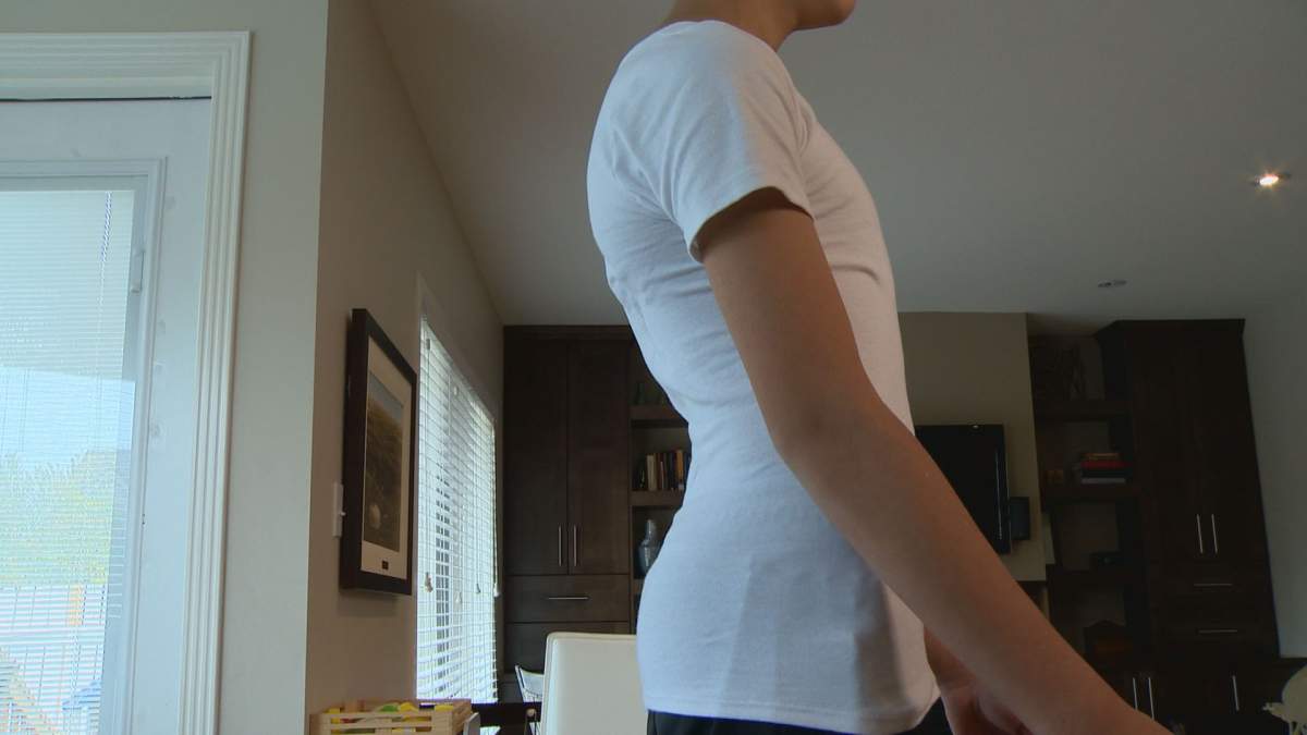 Saskatoon family travels overseas for modern back brace option for son - image