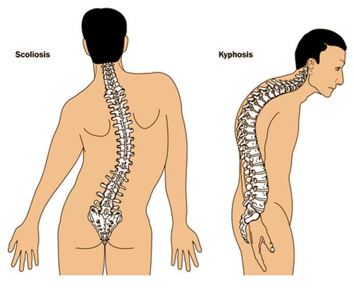 Saskatoon family travels overseas for modern back brace option for son - image
