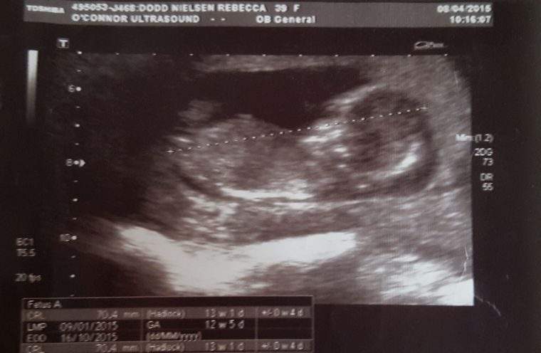 An ultrasound of Baby Margaret
