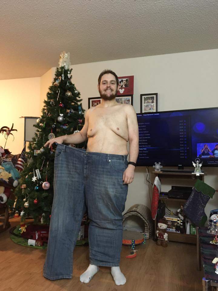 Since April, Traves Bezenar has lost 177 pounds. He’s literally half the size he once was.