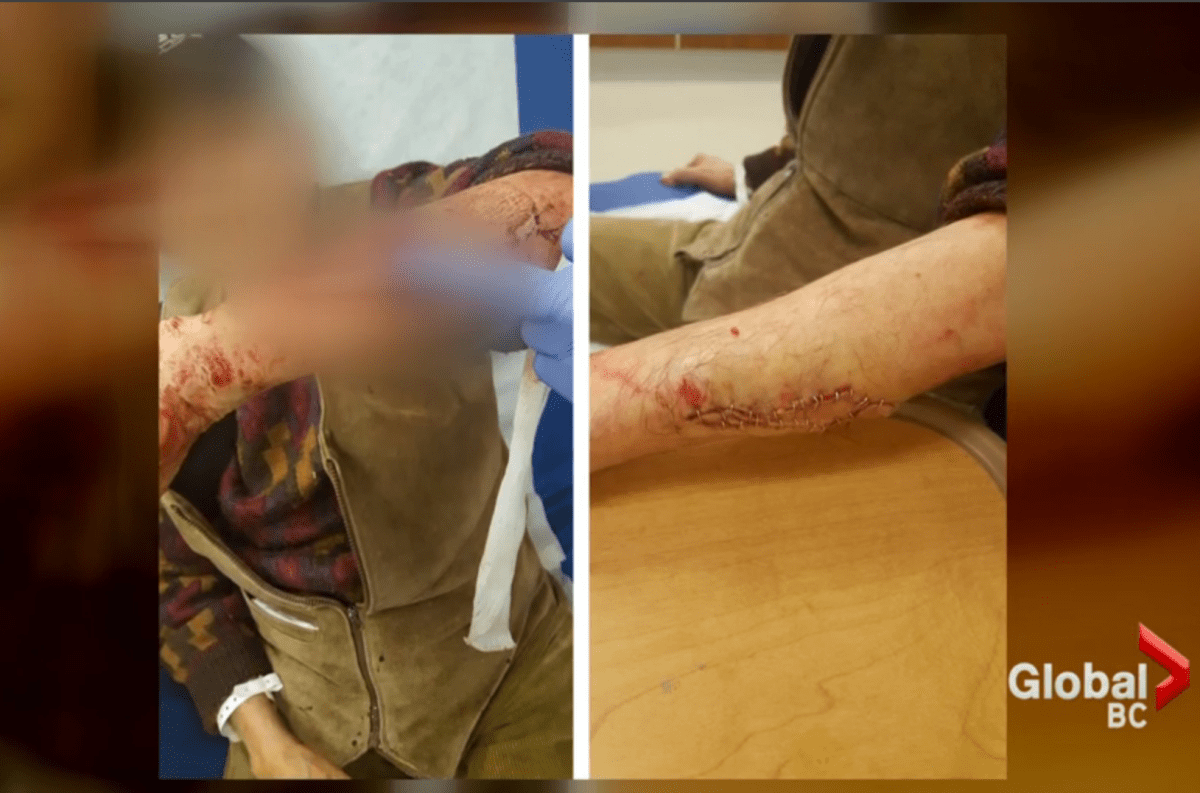 B.C. lawsuit over Surrey pit bull attack could be a warning for all dog owners - image