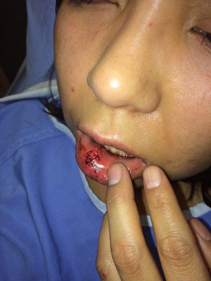 Karalie Red Old Man says she was viciously beaten by a man driving a silver BMW at the West Mount Pleasant arena.