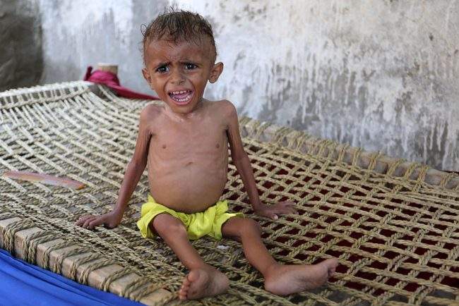 A malnourished Yemeni boy sits on a wooden bench on September 26, 2016 in an impoverished coastal village on the outskirts of the rebel-held Yemeni port city city of Hodeida, where malnutrition has hit the population hard. 