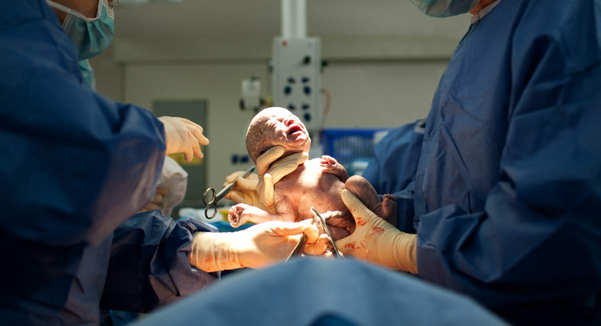 According to CIHI, the rate of women undergoing C-sections in Canada is on the rise, increasing almost nine per cent between 1997 and 2014.