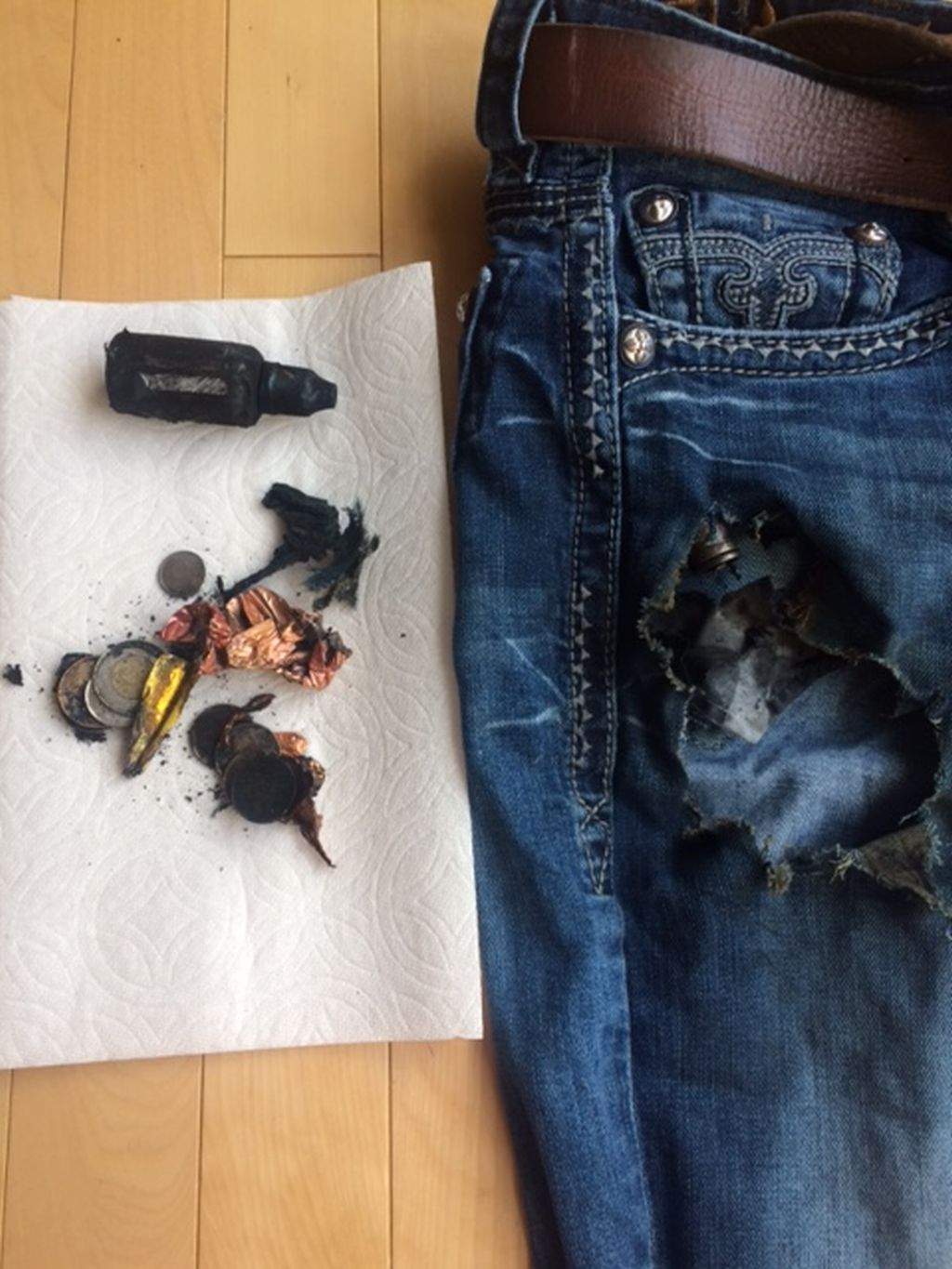 Calgary man suffers 3rd degree burns after e-cigarette battery explodes in pocket - image