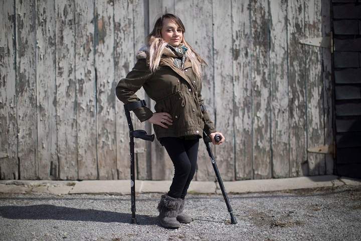Haily Butler-Henderson is photographed near her Toronto home , on Friday March 17, 2017. Butler-Henderson is launching a human rights complaint against a restaurant that wouldn't let her use the washroom because she's on crutches. THE CANADIAN PRESS/Chris Young.