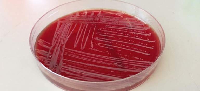 File photo of bacteria being cultured. 