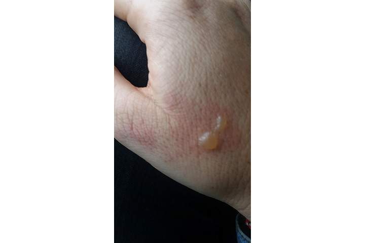 Sleeping passenger suffers burns after her headphones exploded on Australia-bound flight - image