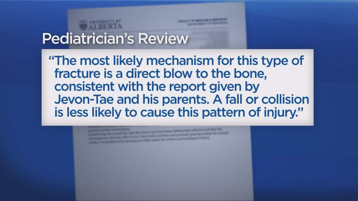 Edmonton family blames alleged slashing incident for breaking 2 bones in young hockey player’s arm - image