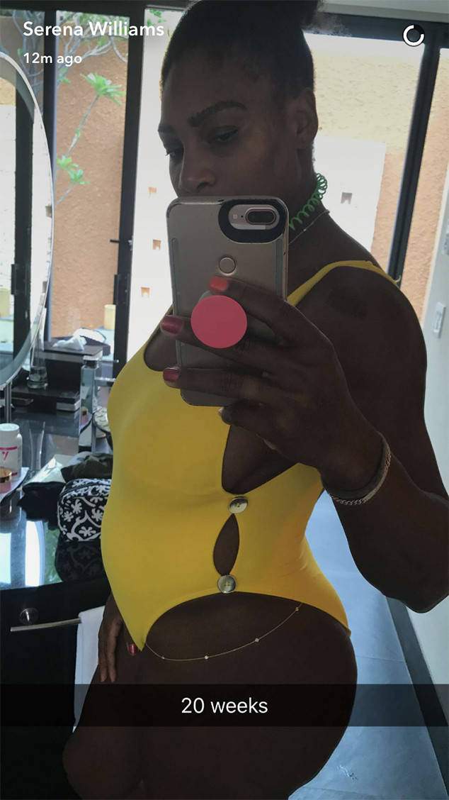 Serena Williams reveals she didn’t intend to announce her pregnancy on social media: ‘It was an accident’ - image