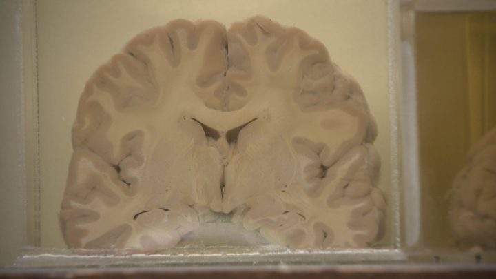 The silent tutor: how your body can help medicine and science - image