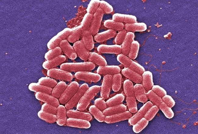 A colorized scanning electron micrograph image of E. coli.