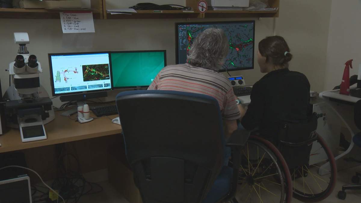 Researchers at the University of Alberta have found increasing oxygen may improve spinal cord injuries.