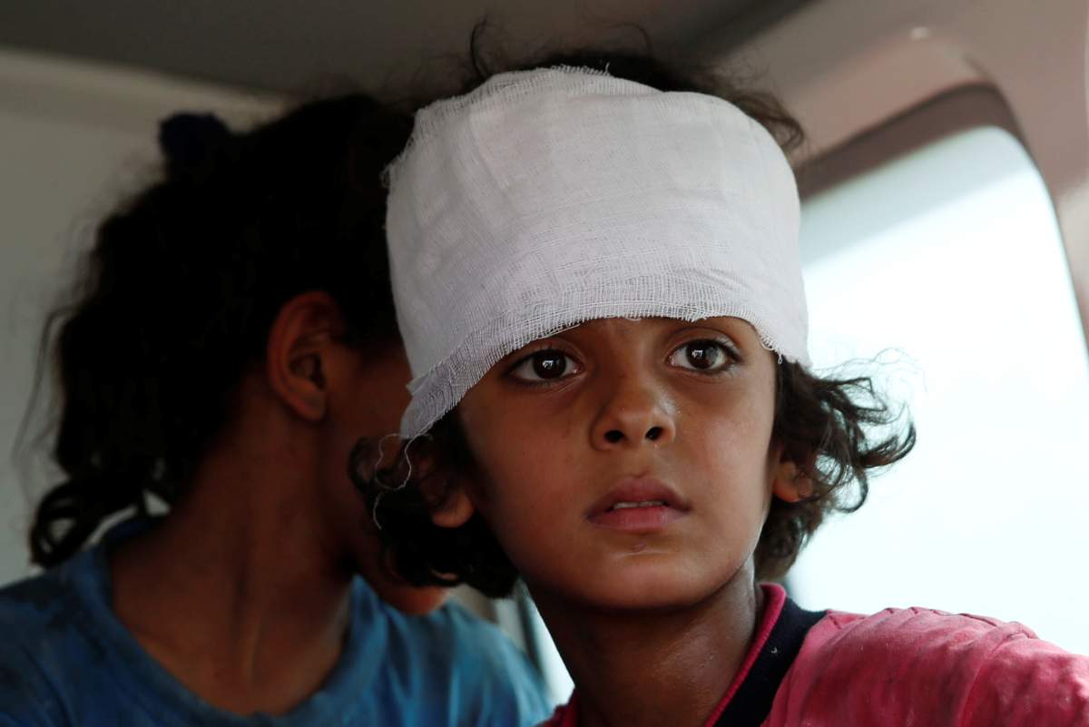 A displaced wounded Iraqi girl rescued at the site of battle is transported by the Iraqi forces at the Old City in Mosul, Iraq June 29, 2017. REUTERS/Erik De Castro