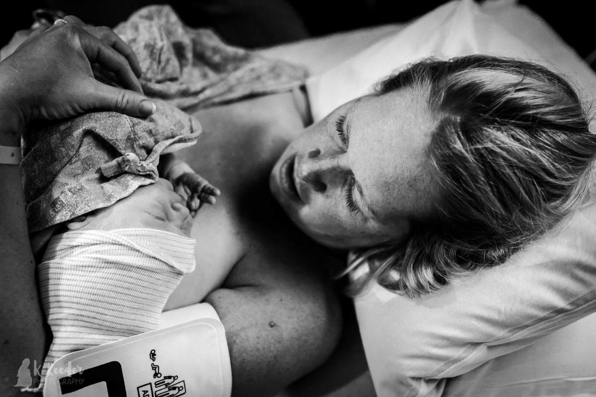 Photographer captures ‘cone head’ baby in incredible birth photos - image
