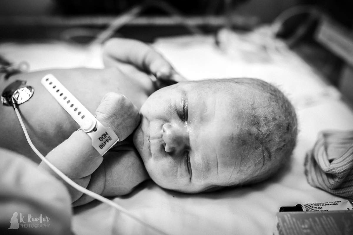 Photographer captures ‘cone head’ baby in incredible birth photos - image