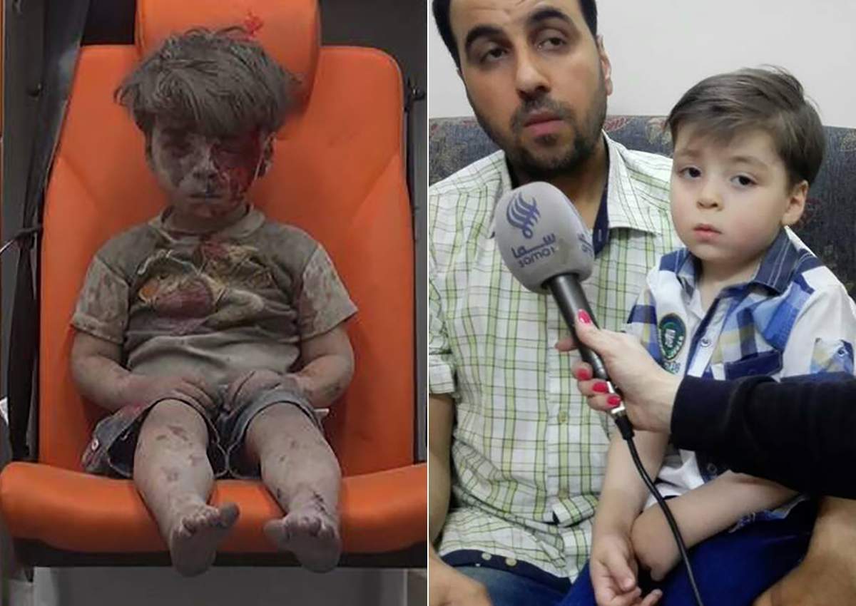New photos of Omran Daqneesh have emerged, almost 10 months after he was reportedly pulled from the rubble of an airstrike in Syria. 