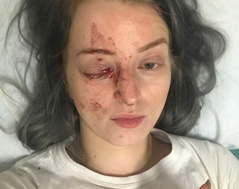 Brittney Thomas-Ljungberg was randomly attacked in the Exchange District Sunday afternoon.