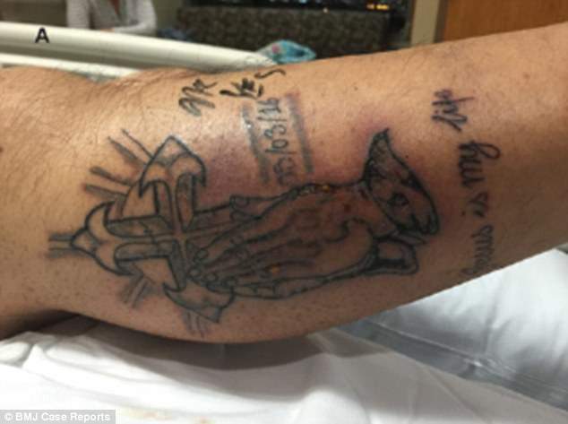 Man’s grisly death a warning not to go swimming right after getting a tattoo - image