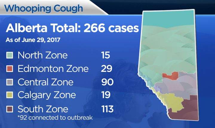 Whooping Cough