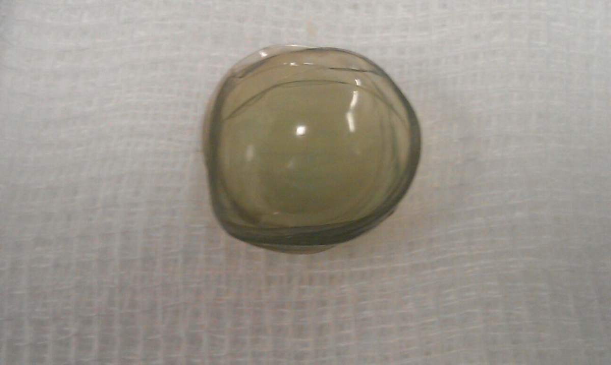 27 contact lens eye