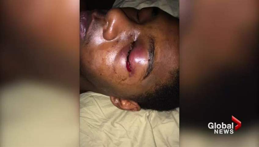 Dafonte Miller was seriously injured after an alleged assault by an off-duty Toronto police officer in Whitby, Ont. on Dec. 28, 2016.