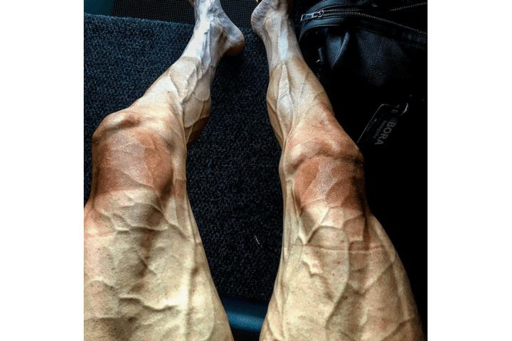 Pawel Poljanski vein legs