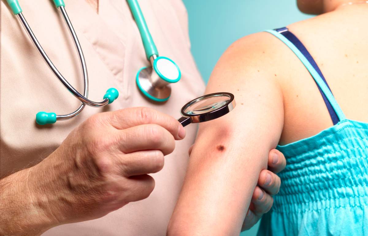 A first-line treatment for melanoma and other cancers seems to work better for men than women, a new study suggests.