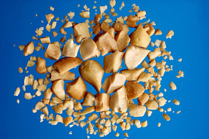 adult food allergies