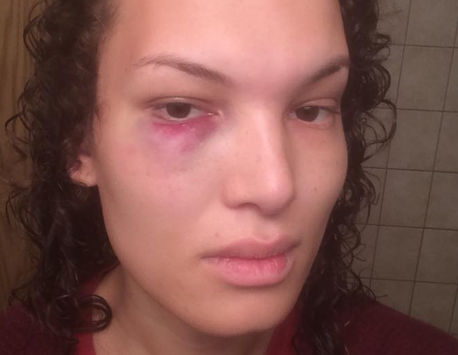 Aisha Walker says she was attacked by a stranger on a local transit bus when she confronted him for sexual harassment of a fellow passenger.