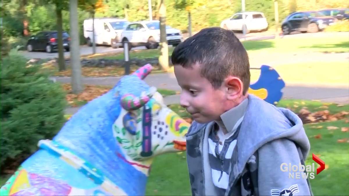 Hassan, 9, was born with a disease known as junctional epidermolysis bullosa, a condition that makes the skin and organs fragile and prone to blistering.