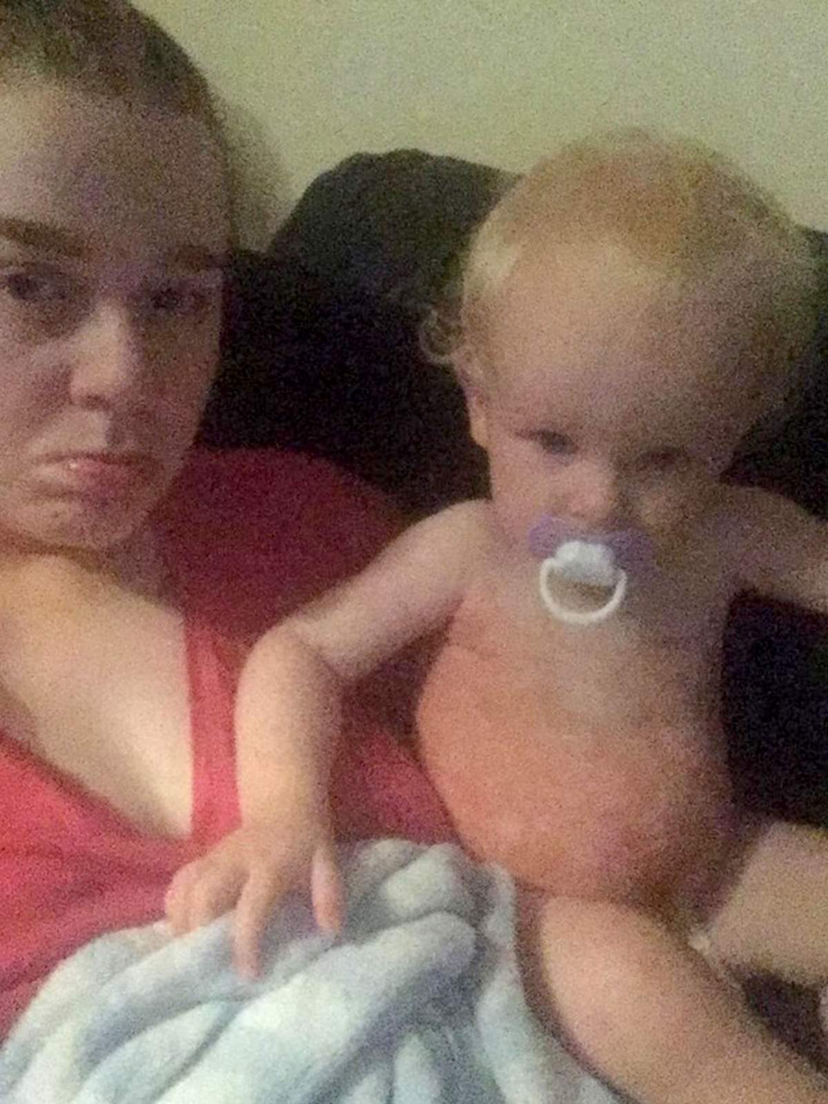 A toddler ‘almost died’ from contracting herpes from a kiss - image