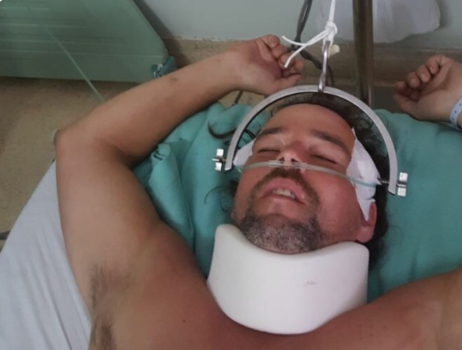 Florida man in serious condition in Bali after falling from roof while chasing monkey - image