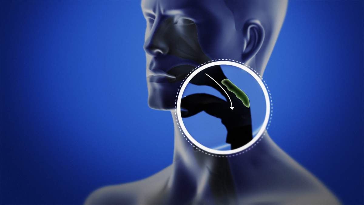 Dry coughs, wet coughs, mucus: Everything you need to know about coughs and phlegm - image