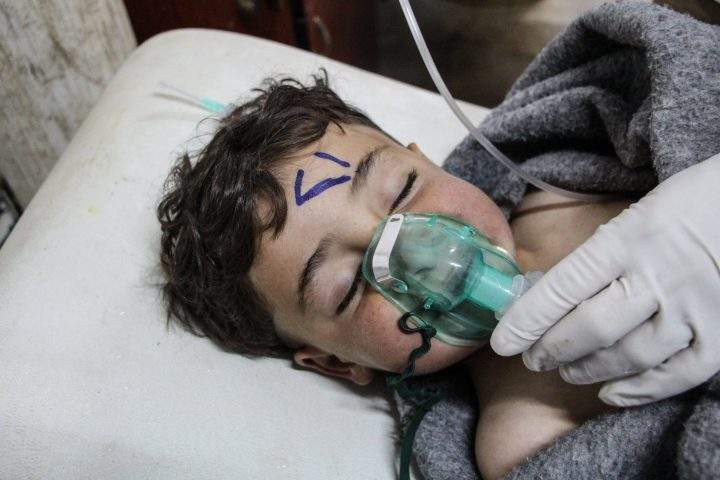 A Syrian child receives treatment after a chemical attack.