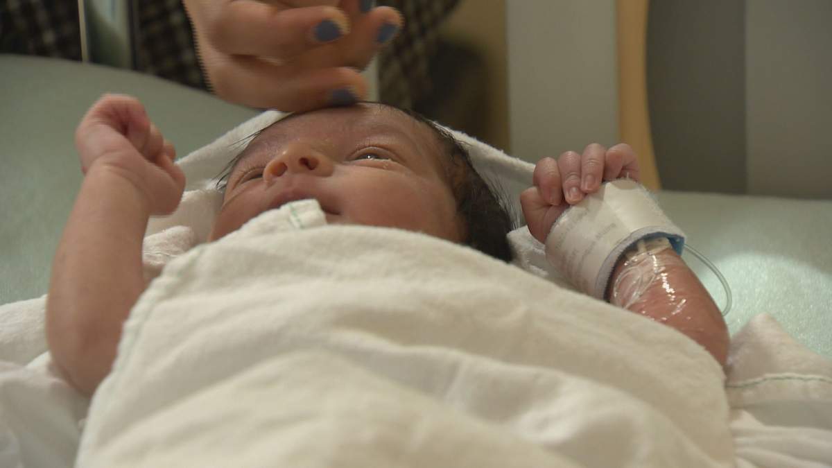 Study finds breast milk sugar may help stop food allergies in babies - image