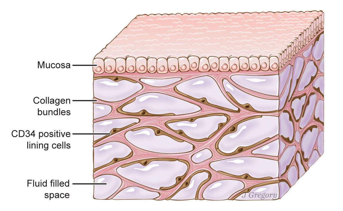 A diagram of tissue in the interstitium.