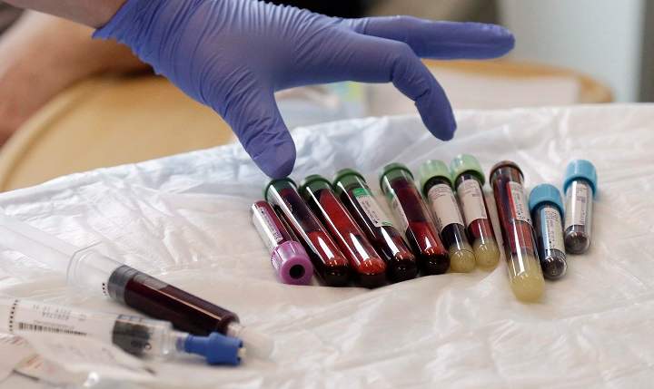 In this photo taken March 21, 2017, a nurse reaches for blood samples taken from a patient receiving a kind of immunotherapy known as CAR-T cell therapy at the Fred Hutchinson Cancer Research Center in Seattle. 