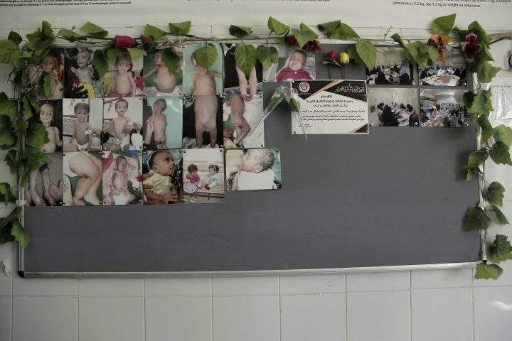 This Feb. 13, 2018 photo shows photographs of severely malnourished infants hung on wall in the administrative office at the Aden Hospital, in Yemen.