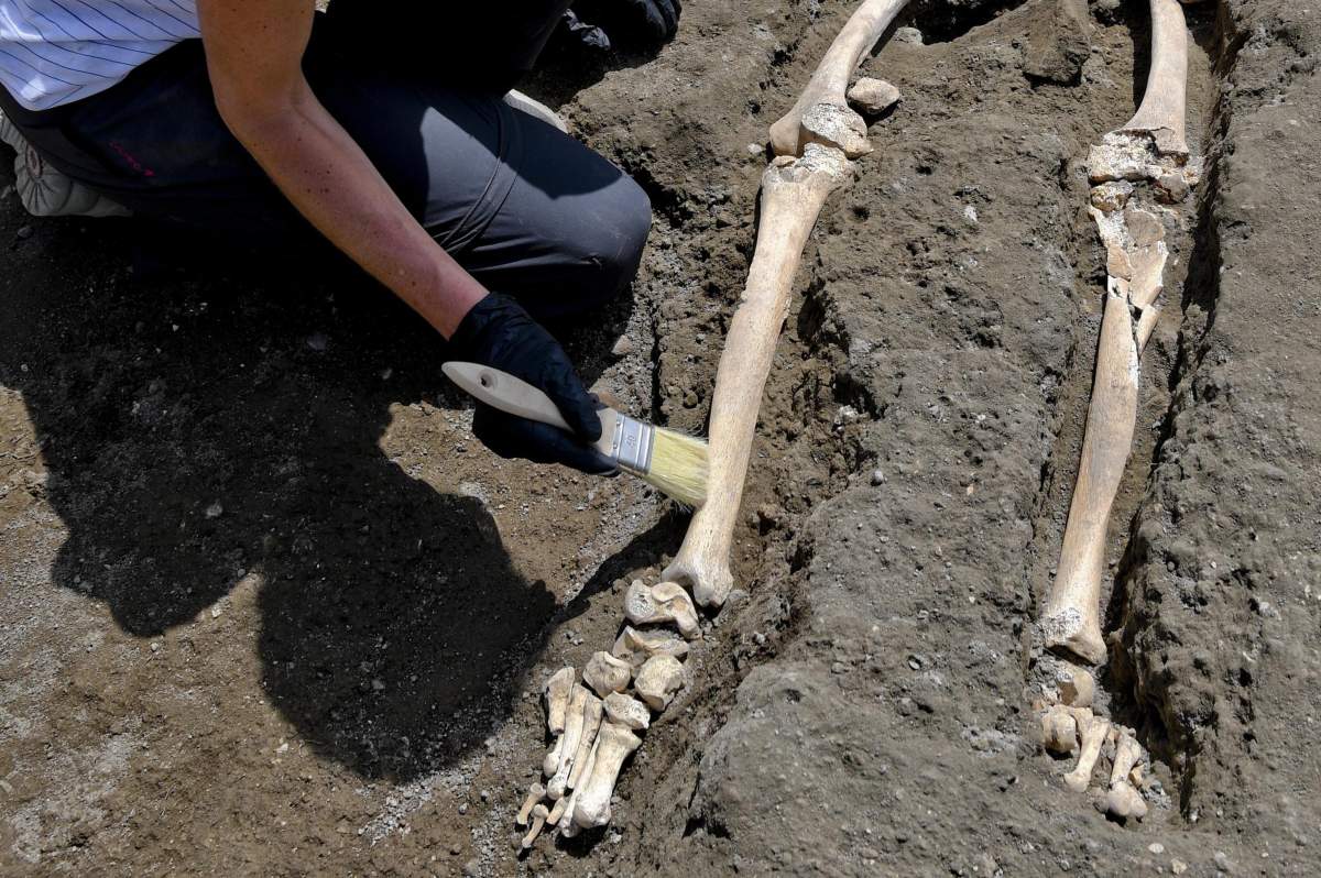 Archaeologists say the skeleton shows signs of a bone infection in his leg, which could have made walking difficult.