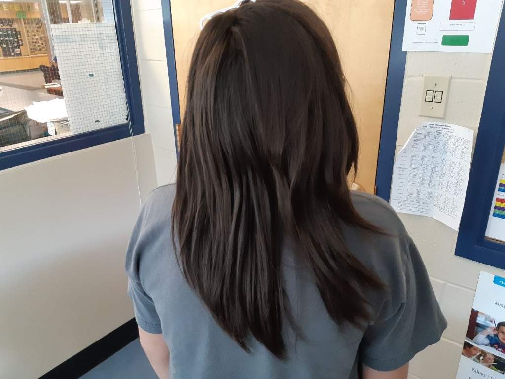 Rafe Vadnais with chunk of hair missing