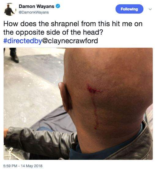 ‘Lethal Weapon’ star Damon Wayans posts video, photos accusing Clayne Crawford of on-set violence - image