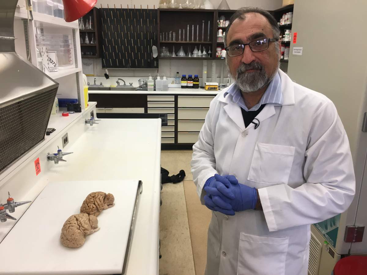 Dr. Sultan Darvesh and his team are advancing research into Alzheimer’s disease that aims to be able to fully diagnose people while they’re still living.