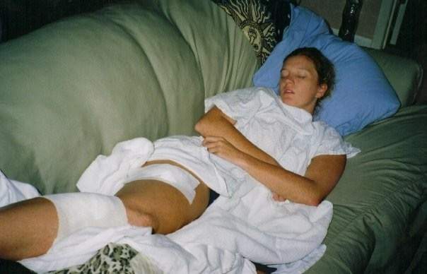 Woman opens up about surviving 86 skin-cancer surgeries: ‘I don’t have quit in me’ - image